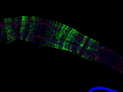 Hindgut