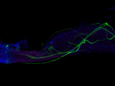Hindgut