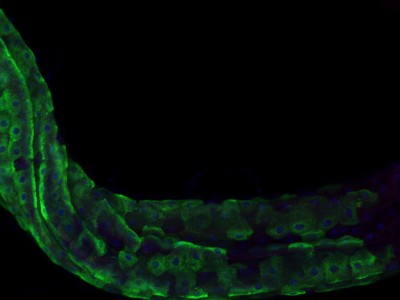Hindgut